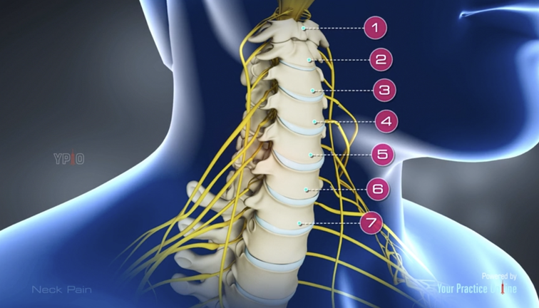 Neck Pain