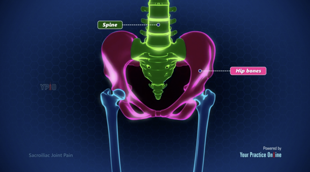 Sacroiliac Joint Pain